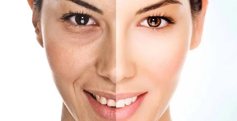 Anti-Aging Treatment treatment