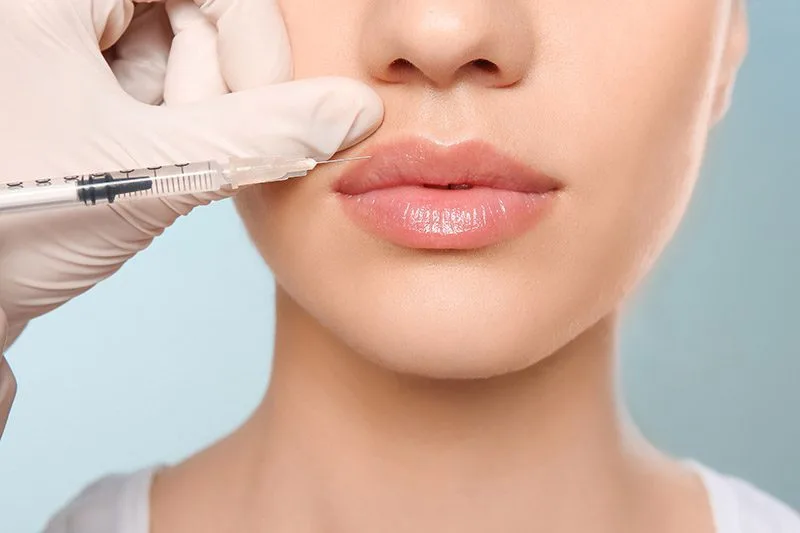 Dermal Fillers treatment
